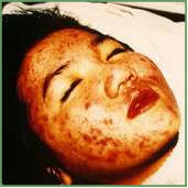 Danne skin therapy beauty acne anti aging Environ pigmentation scar