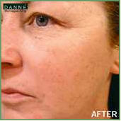 Danne skin therapy beauty acne anti aging Environ pigmentation