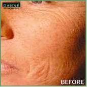 Danne skin therapy beauty acne anti aging Environ pigmentation