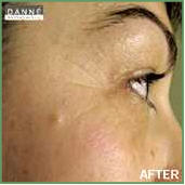Danne skin therapy beauty acne anti aging Environ