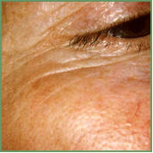 Danne skin therapy beauty acne anti aging Environ pigmentation scar